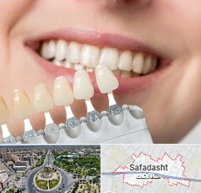 مرکز کامپوزیت دندان در صفادشت