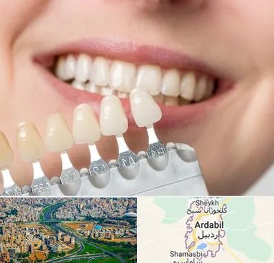 مرکز کامپوزیت دندان در اردبیل