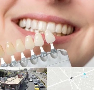مرکز کامپوزیت دندان در خیابان دماوند
