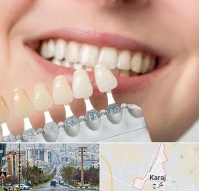 مرکز کامپوزیت دندان در گوهردشت