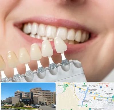 مرکز کامپوزیت دندان در صیاد شیرازی مشهد