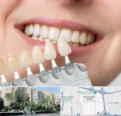 مرکز کامپوزیت دندان در آپادانا