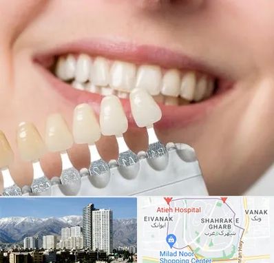 مرکز کامپوزیت دندان در شهرک غرب تهران