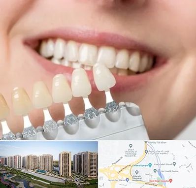 مرکز کامپوزیت دندان در المپیک