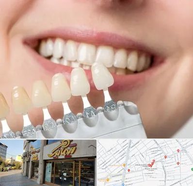 مرکز کامپوزیت دندان در عطاران قم