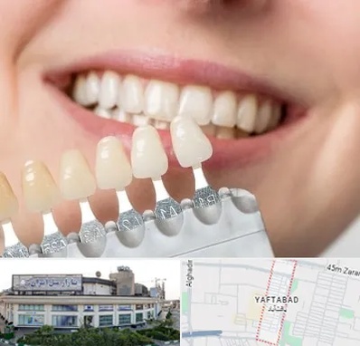 مرکز کامپوزیت دندان در یافت آباد