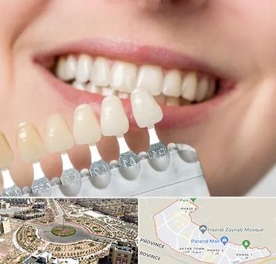 مرکز کامپوزیت دندان در پرند