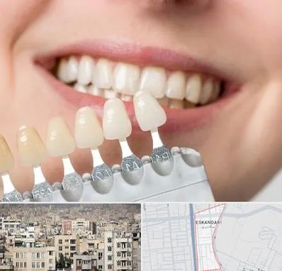 مرکز کامپوزیت دندان در اسکندری