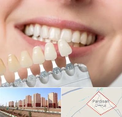 مرکز کامپوزیت دندان در پردیسان قم