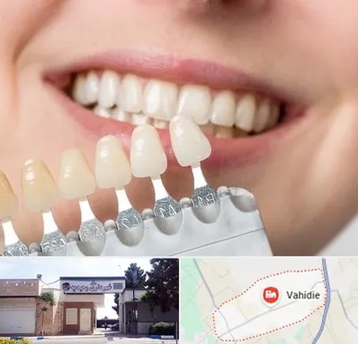 مرکز کامپوزیت دندان در وحیدیه شهریار