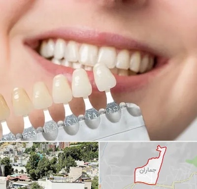 مرکز کامپوزیت دندان در جماران
