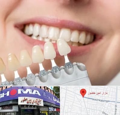 مرکز کامپوزیت دندان در امین حضور