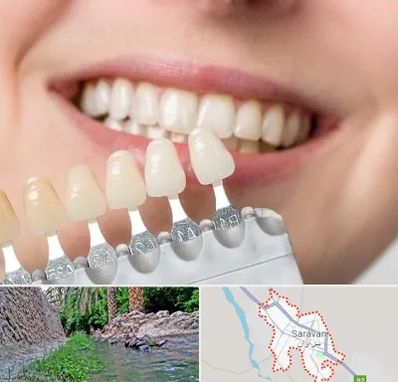 مرکز کامپوزیت دندان در سراوان