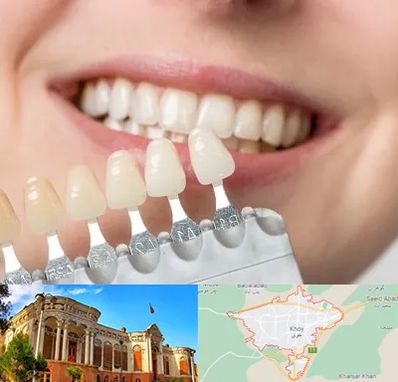 مرکز کامپوزیت دندان در خوی