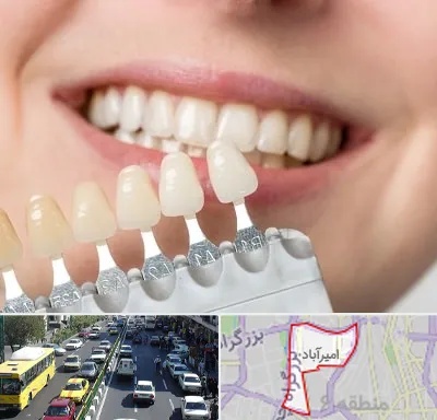 مرکز کامپوزیت دندان در امیرآباد