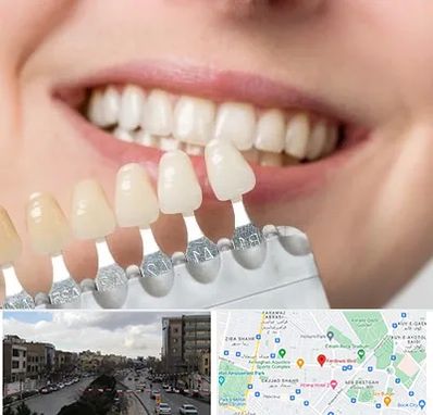 مرکز کامپوزیت دندان در بلوار فردوسی مشهد