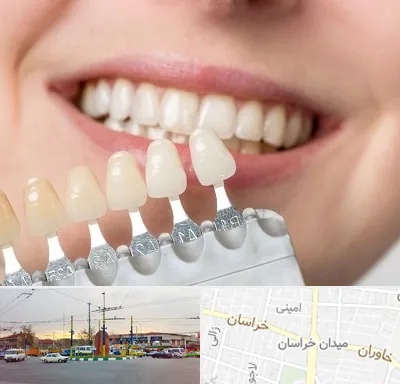 مرکز کامپوزیت دندان در میدان خراسان