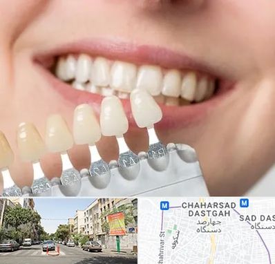 مرکز کامپوزیت دندان در چهارصد دستگاه