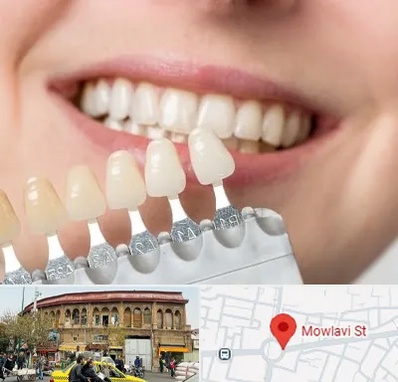 مرکز کامپوزیت دندان در مولوی