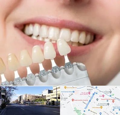 مرکز کامپوزیت دندان در خیابان ملاصدرا شیراز