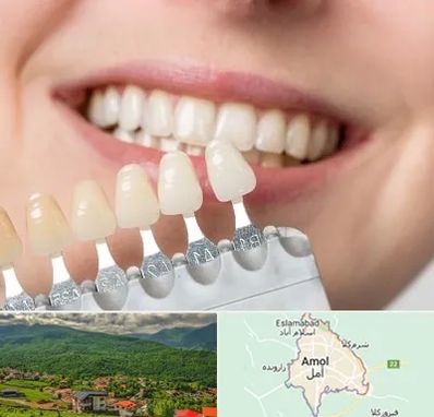 مرکز کامپوزیت دندان در آمل