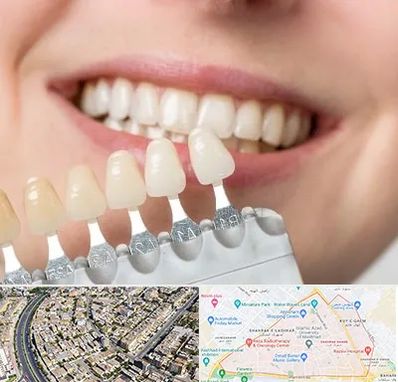 مرکز کامپوزیت دندان در شهرک غرب مشهد