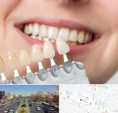 مرکز کامپوزیت دندان در بلوار معلم مشهد
