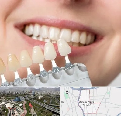 مرکز کامپوزیت دندان در عباس آباد تهران