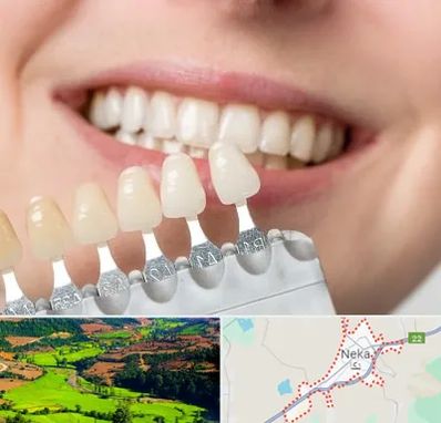 مرکز کامپوزیت دندان در نکا