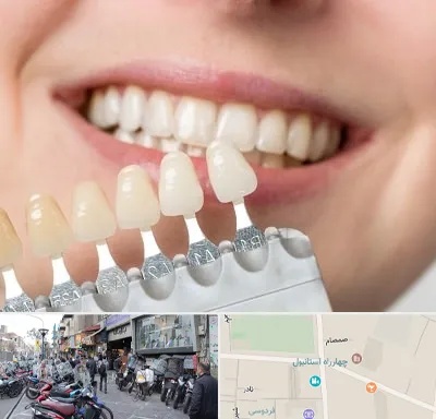 مرکز کامپوزیت دندان در چهارراه استانبول