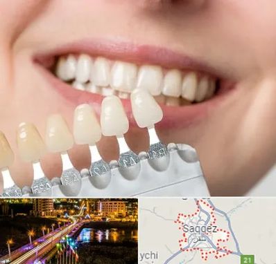 مرکز کامپوزیت دندان در سقز