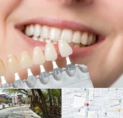 مرکز کامپوزیت دندان در خیابان توحید اصفهان