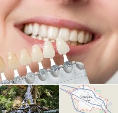 مرکز کامپوزیت دندان در الیگودرز