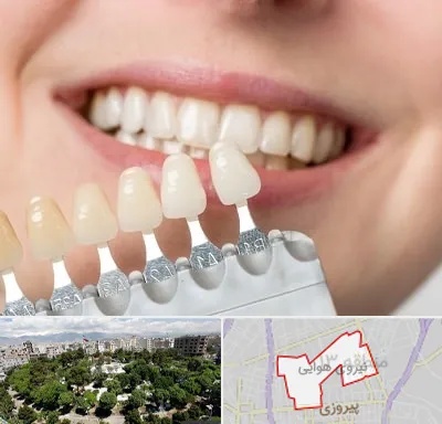 مرکز کامپوزیت دندان در نیروی هوایی