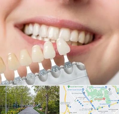 مرکز کامپوزیت دندان در قدوسی غربی شیراز