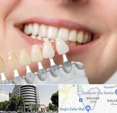 مرکز کامپوزیت دندان در قلهک