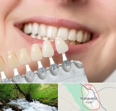 مرکز کامپوزیت دندان در نهاوند