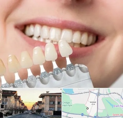مرکز کامپوزیت دندان در کوهک