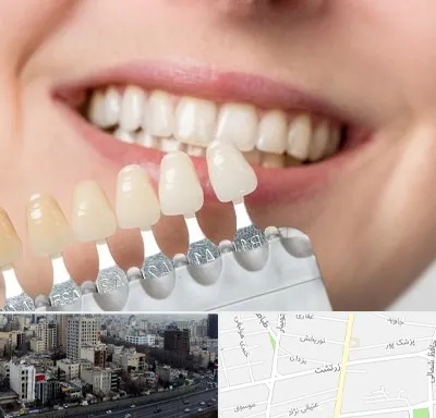 مرکز کامپوزیت دندان در زرتشت