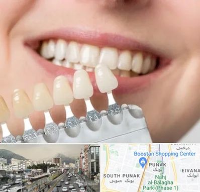 مرکز کامپوزیت دندان در پونک