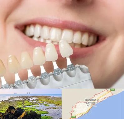 مرکز کامپوزیت دندان در بندرلنگه