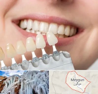 مرکز کامپوزیت دندان در میگون