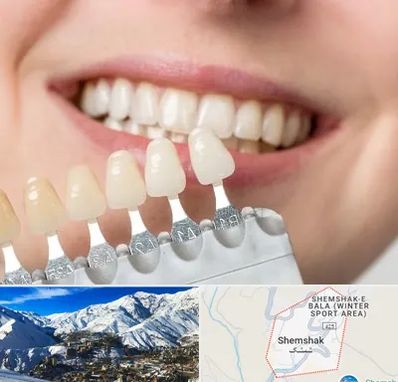 مرکز کامپوزیت دندان در شمشک