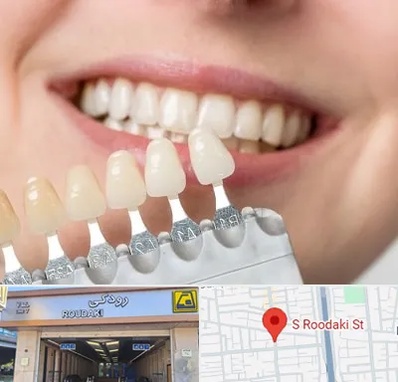 مرکز کامپوزیت دندان در رودکی