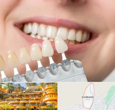 مرکز کامپوزیت دندان در دربند