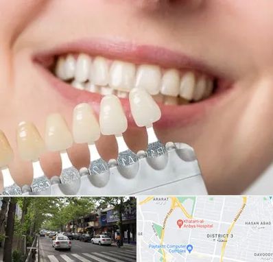 مرکز کامپوزیت دندان در ظفر