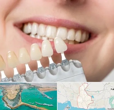 مرکز کامپوزیت دندان در سیستان و بلوچستان