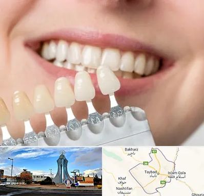 مرکز کامپوزیت دندان در تایباد