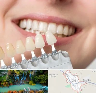 مرکز کامپوزیت دندان در دورود