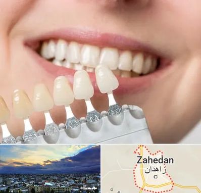 مرکز کامپوزیت دندان در زاهدان